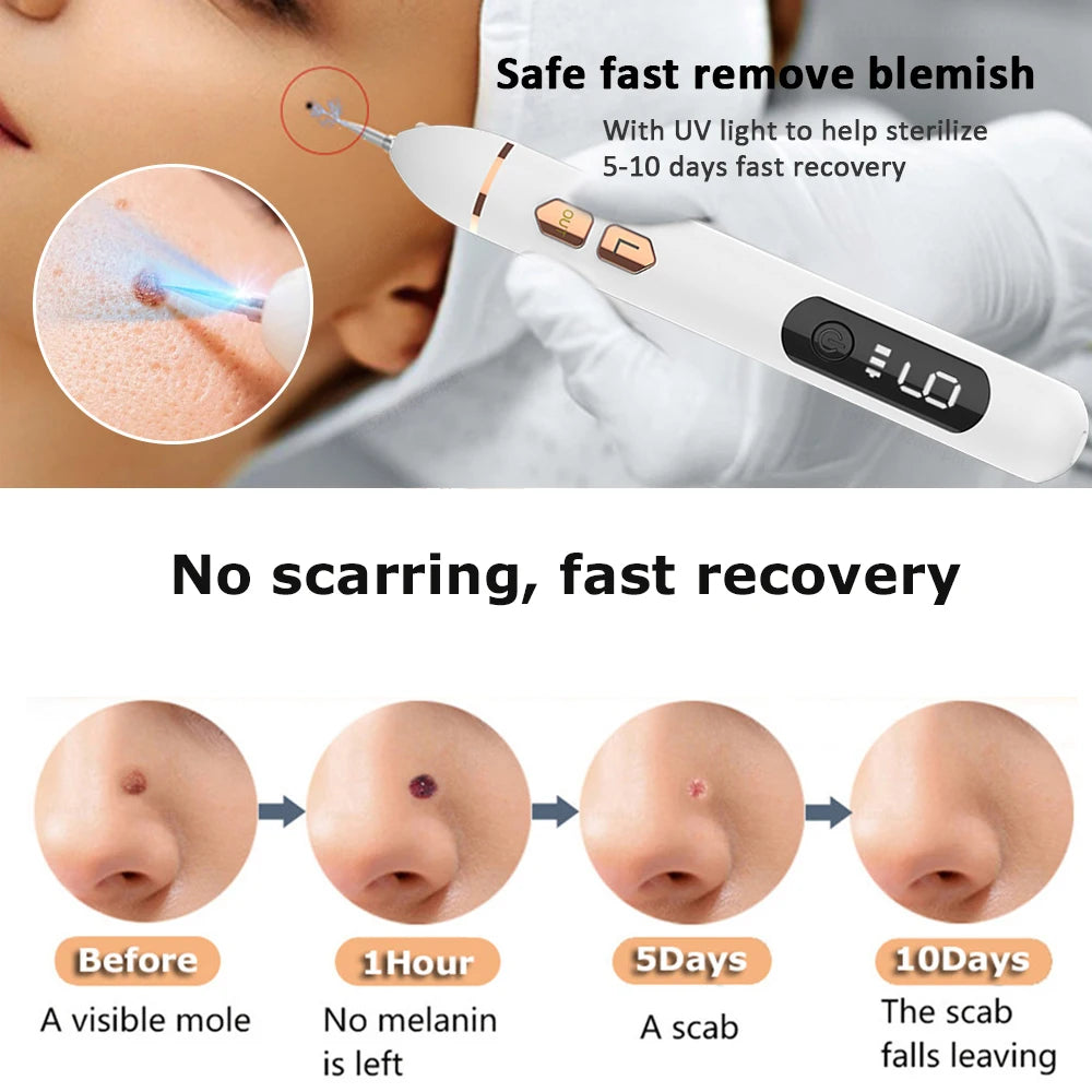 Laser Plasma Pen Skin Tag Remover Electric Mole Wart Remover Nevus Black Spots Removal Face Body Mole Remover 2053