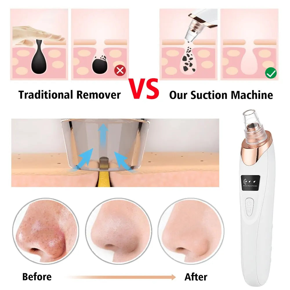 Electric Cleaner Face Blackhead Remover Multifunctional Cleaning Instrument Black Head Extractor Face Skin Care Tools